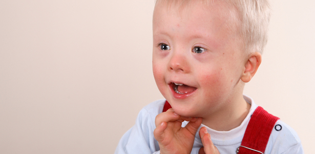 Down syndrome in children birkdale neuro